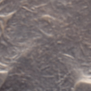 Ausschnitt zur Qualitätsprüfung vom Digitalen Bild Qualität