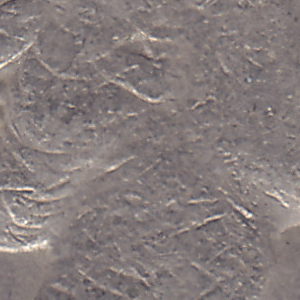 Ausschnitt zur Qualitätsprüfung vom Digitalen Bild Qualität